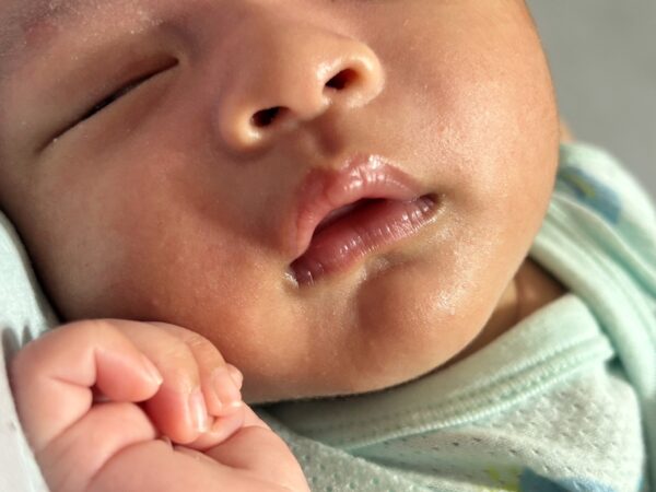 新生的寶寶可能會出現上嘴唇有白白的水泡，稱「吸吮墊」或「吸吮繭」，也有人稱之為「奶泡」。圖／曾璟星攝