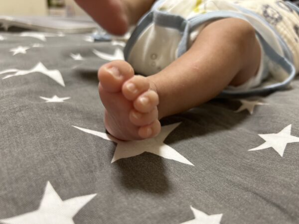 新生兒腳趾重疊是一種常見的問題。圖／曾璟星攝