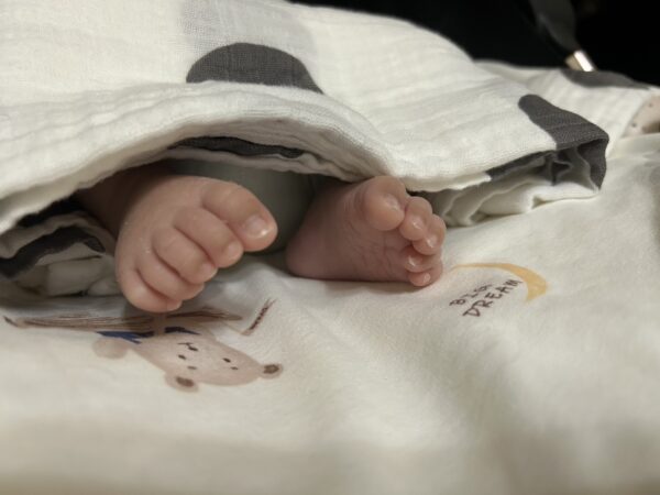 新生兒腳趾重疊：了解、處理和預防